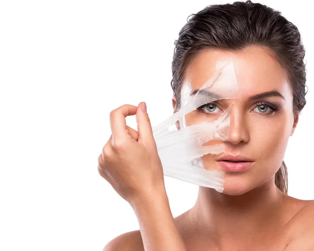 Chemical Peel Treatment