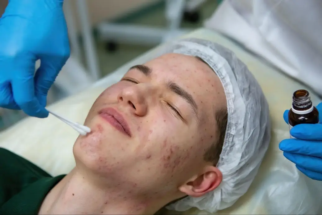 Skin specialist in Kannur performing a skin-barrier treatment on an acne-prone patient
        