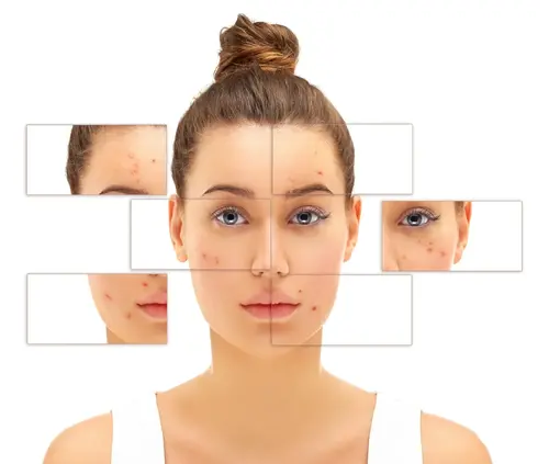 Skin Conditions that a can Dermatologist Treat in Kannur